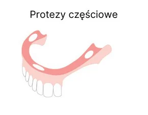 ISODENT Adhesive Cream for Dentures 40 g – krem adhezyjny do protez zapewniający komfort i pewność każdego dnia - obrazek 3
