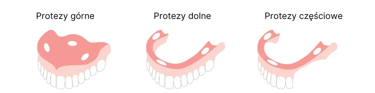 ISODENT Adhesive Cream for Dentures 40 g – krem adhezyjny do protez zapewniający komfort i pewność każdego dnia - obrazek 2