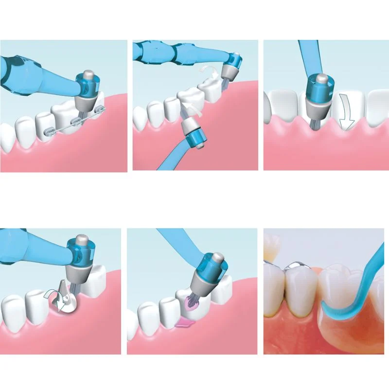 Miradent I-Prox Care Set zestaw do samokontroli jamy ustnej, lusterko+kireta + szczoteczka jednopęczkowa - obrazek 2